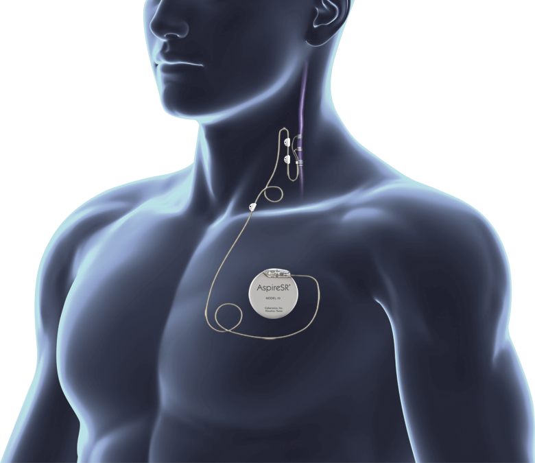 AspireSR™ VNS Therapy device