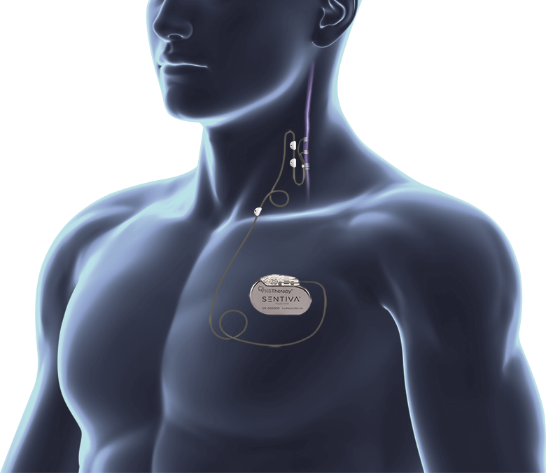 SenTiva™ VNS Therapy device