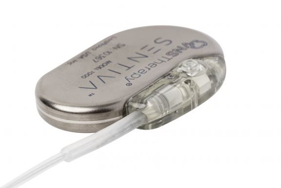 How a tiny implant can stop seizures from happening